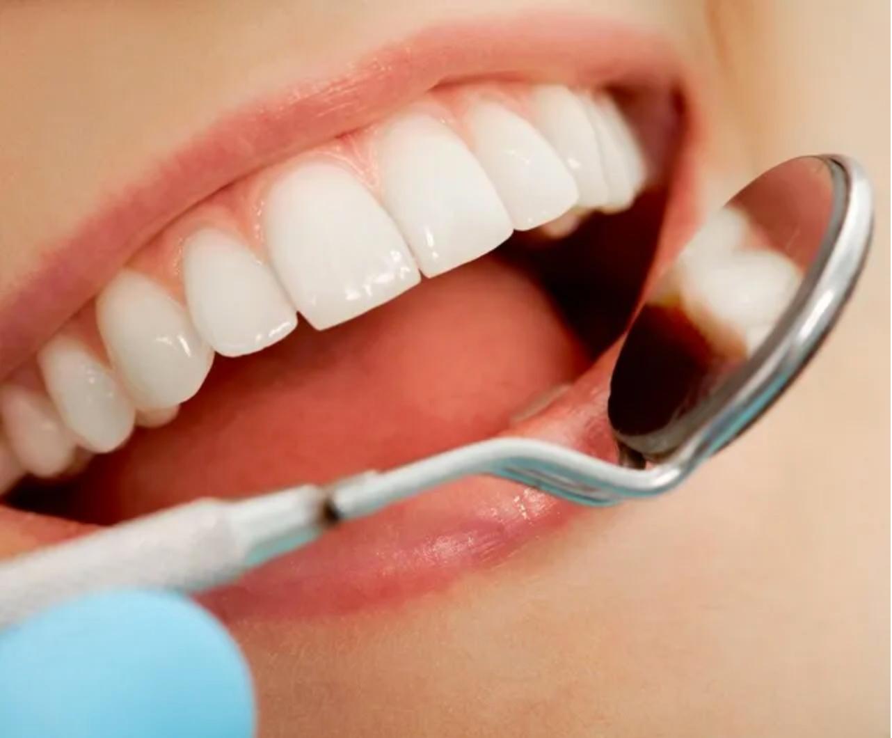 Portfolio item's cover image