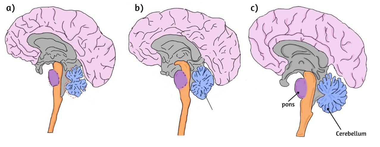 Portfolio item's cover image