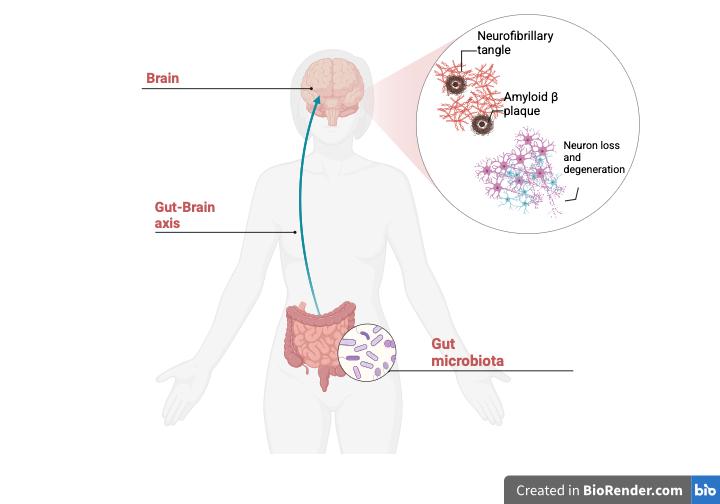 Portfolio item's cover image