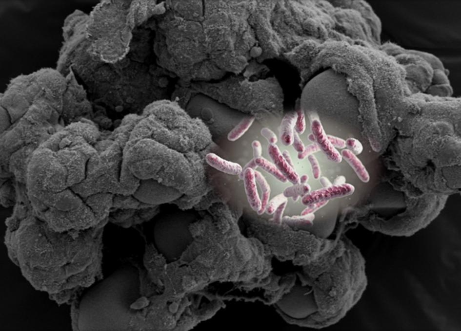 Portfolio item's cover image