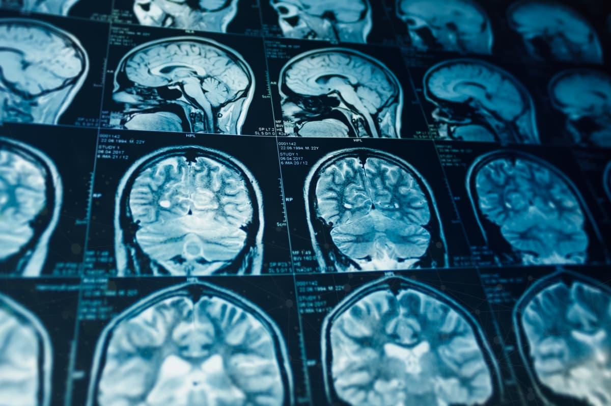 Portfolio item's cover image