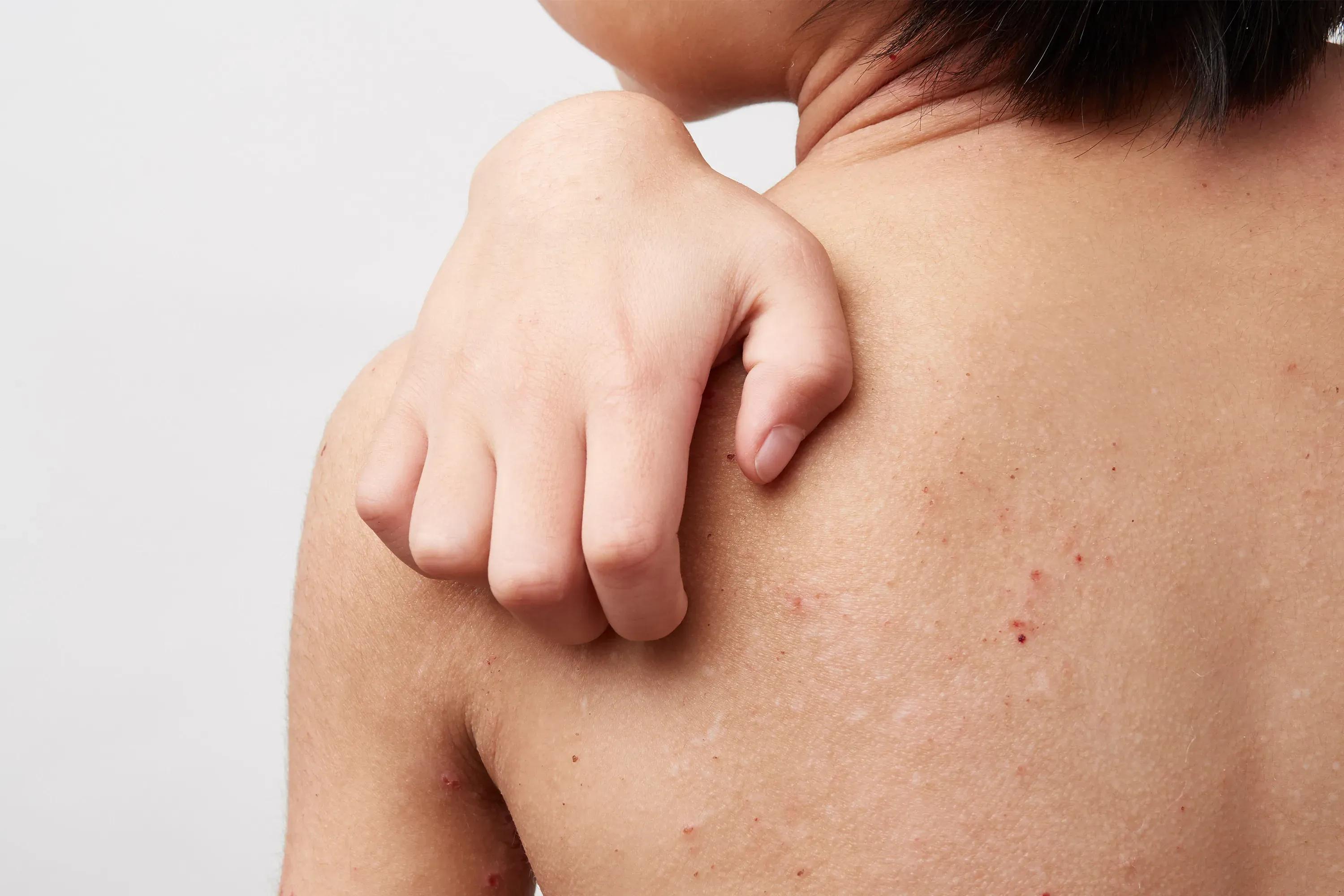 Portfolio item's cover image