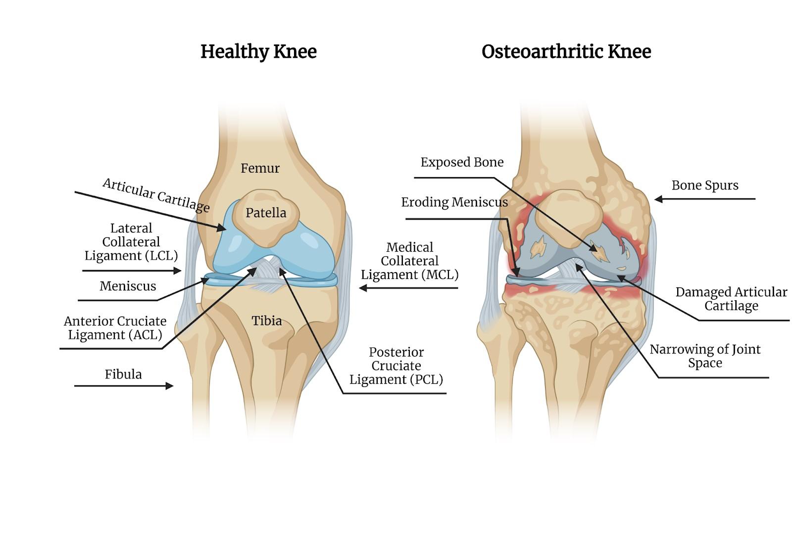 Portfolio item's cover image