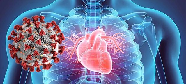 Portfolio item's cover image