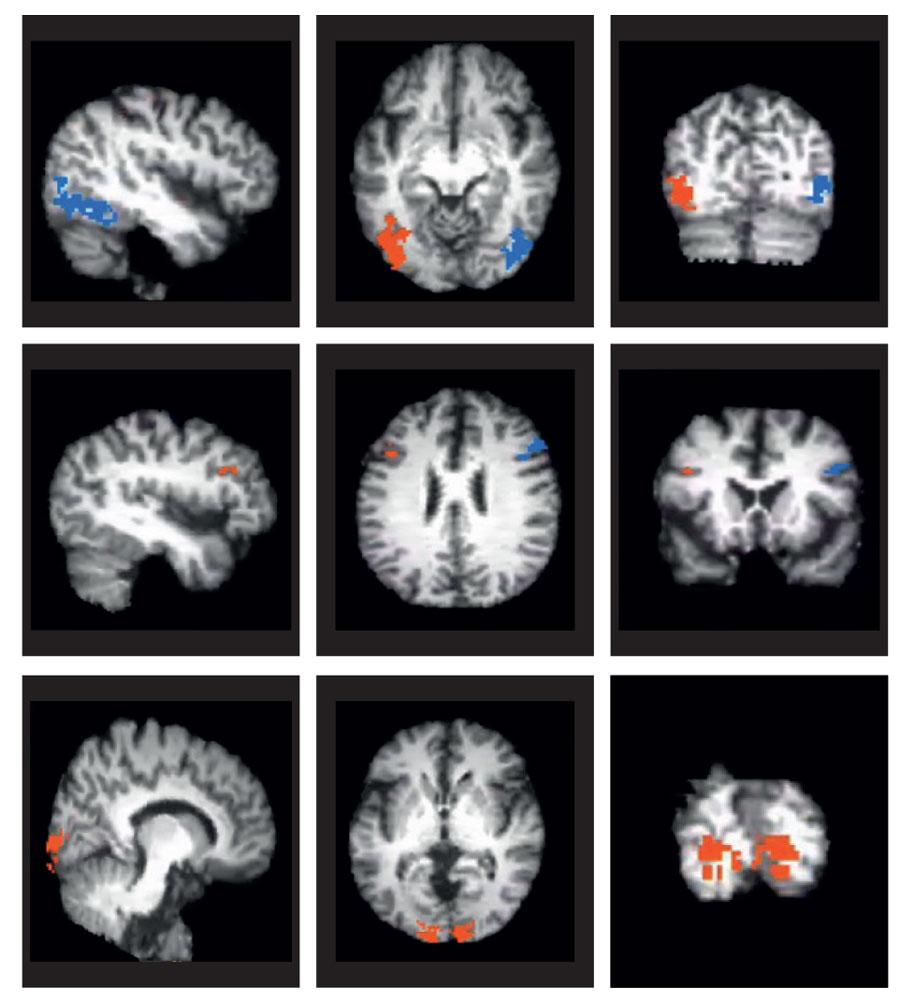 Portfolio item's cover image