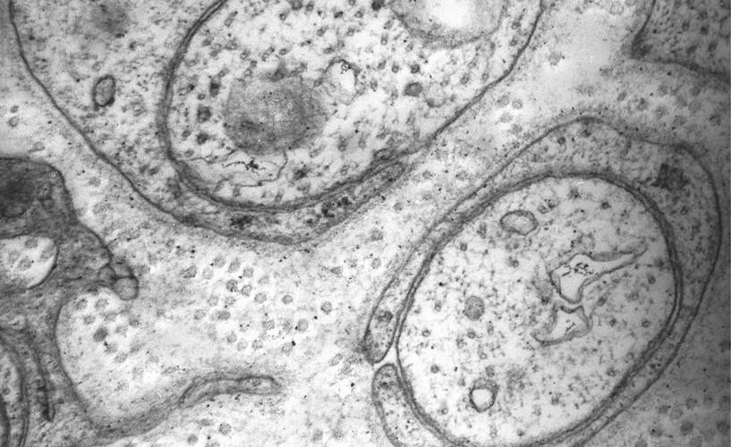 Portfolio item's cover image