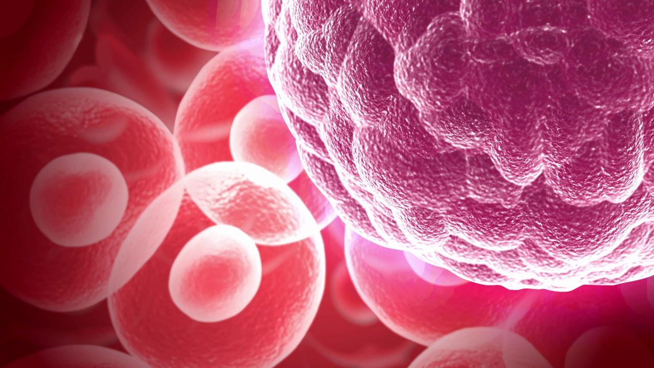 Portfolio item's cover image